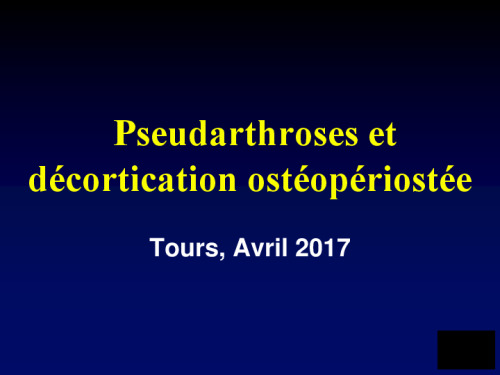 cours de Tours 2017 : traitement des fractures - 2
