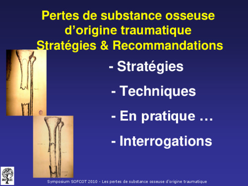 cours de Tours 2017 : traitement des fractures - 13