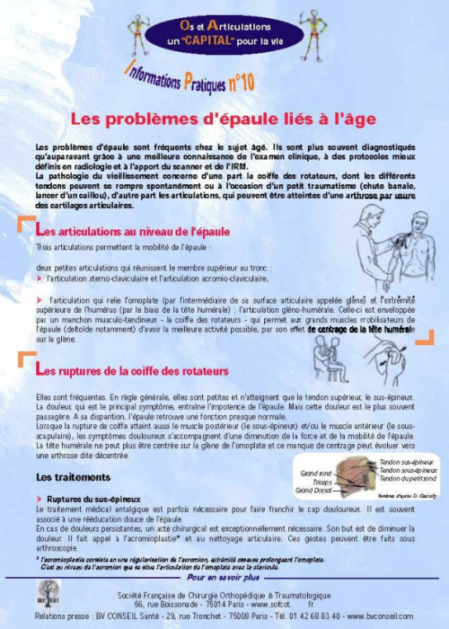 Les problèmes d'épaule liés à l'âge