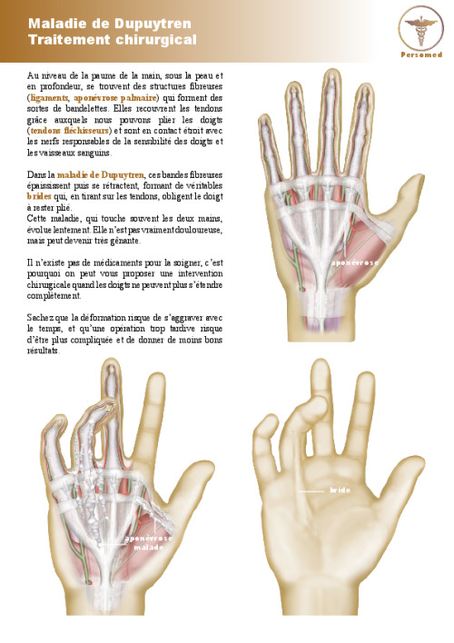 Maladie de Dupuytren Traitement chirurgical