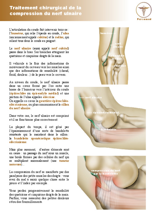 Traitement chirurgical de la compression du nerf ulnaire
