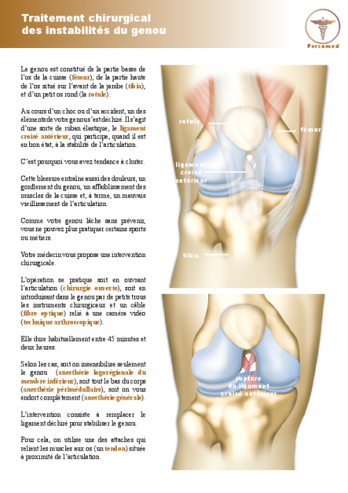 Traitement chirurgical des instabilités du genou