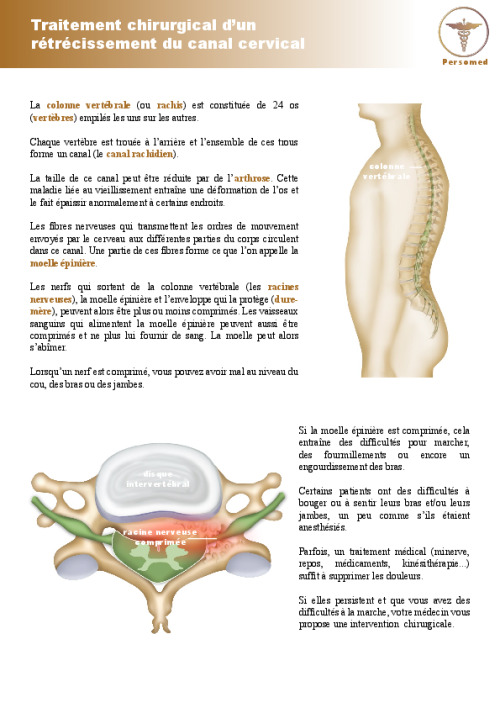 Traitement chirurgical d’un rétrécissement du canal cervical