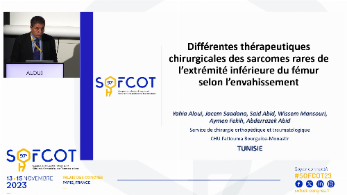 Table ronde OTSF : Différentes thérapeutiques chirurgicales des sarcomes rares de l’extrémité inférieure du fémur selon l’envahissement