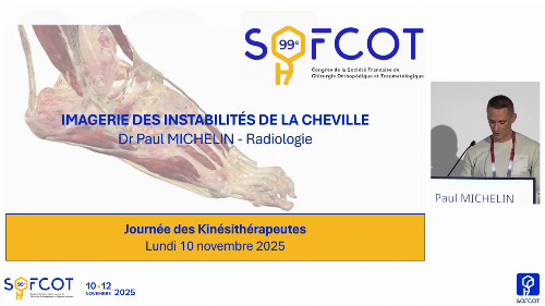 Session cheville : L’imagerie médicale dans un contexte de sollicitation forcée en varus/valgus de la cheville