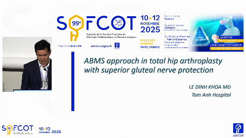 Table ronde VOA  : Evaluation outcomes of abms approach in total hip Arthroplasty with superior gluteal nerve preservation
