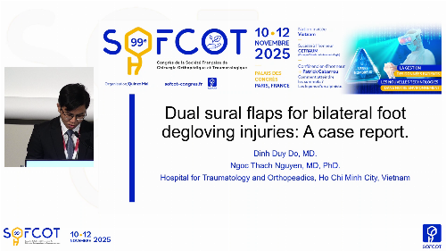 Table ronde VOA  : Dual sural flaps for bilateral foot degloving injuries - A case report