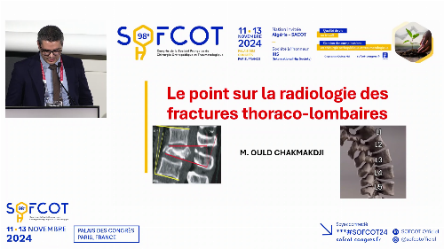 Le point sur les fractures du rachis dorsolombaire 