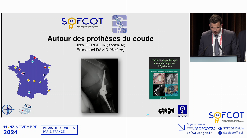Factures autour du coude 