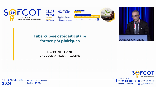 Tuberculose ostéoarticulaire périphérique 