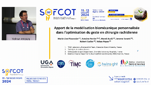 Apport de la modélisation biomécanique personnalisée dans l’optimisation du geste en chirurgie rachidienne 