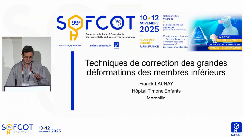 Conférence d'enseignement : CE 13 Techniques de correction des grandes déformations des membres inférieurs