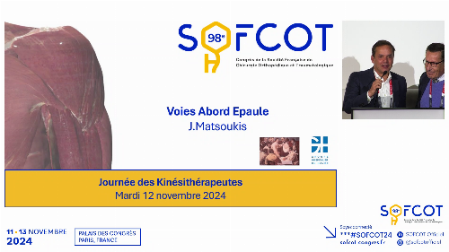 Les différentes voies d’abord chirurgicales de l’épaule 
