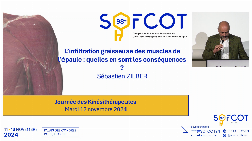 L’infiltration graisseuse au niveau des muscles de l’épaule : quelles en sont les conséquences