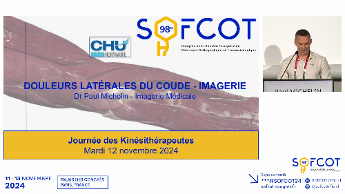 L’imagerie médicale dans les douleurs latérales du coude 