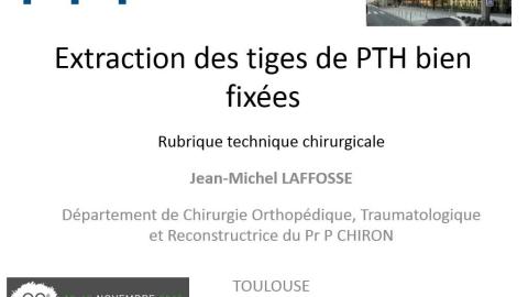 Extraction des tiges de PTH bien fixees - JM. LAFOSSE