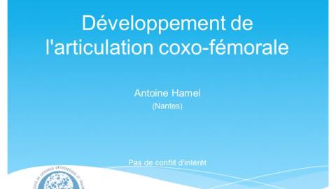 SYMPOSIUM : Conflit fémoro-acétabulaire de l’enfant à l’adulte - 2