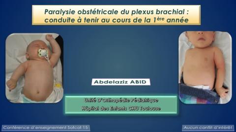 Paralysie obstétricale du plexus brachial : conduite à tenir la première année	