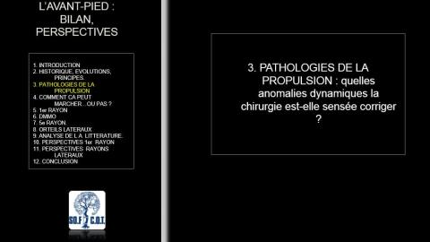 Table ronde : Chirurgie percutanée de l’avant-pied - 2