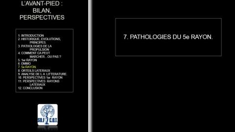 Table ronde : Chirurgie percutanée de l’avant-pied - 6