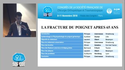 TABLE- Fracture du poignet après 65 ans -  Epidémiologie 02/09
