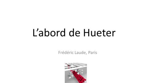 Dans le labyrinthe des voies d’abord de la hanche	 (2)