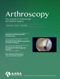 Arthroscopy