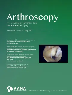 Arthroscopy