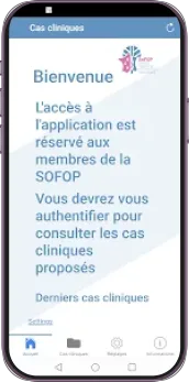 Sofop application mobile