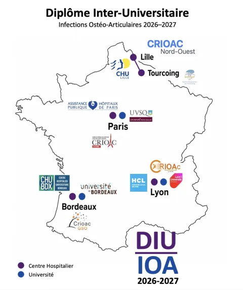 DIU IOA