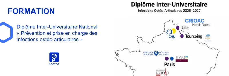 DIU IOA